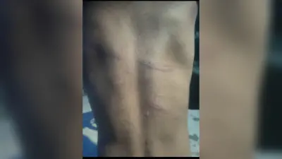कैमूर में अंबेडकर आवासीय विद्यालय में 5 साल के मासूम की डंडे से पिटाई, आठवीं के छात्र पर बड़ी कार्रवाई