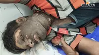 मकान निर्माण के दौरान 33 हजार वोल्ट तार की चपेट में आया राजमिस्त्री, हालत चिंताजनक