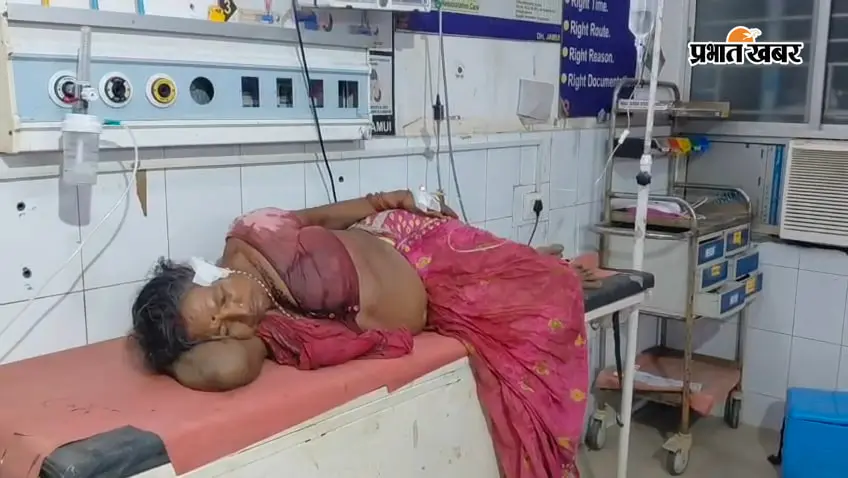 फोटो सदर अस्पताल में इलाजरत घायल | Prabhat Khabar Network फोटो सदर अस्पताल में इलाजरत घायल | Prabhat Khabar Network