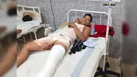 बाबाधाम जा रहे डाक बम श्रद्धालु का संतुलन बिगड़ा, पैर टूटा, कटोरिया सीएचसी से देवघर रेफर