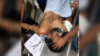 बीरभूम में कपड़ा कारोबारी समेत 3 पर अंधाधुंध फायरिंग, 1 की हालत नाजुक