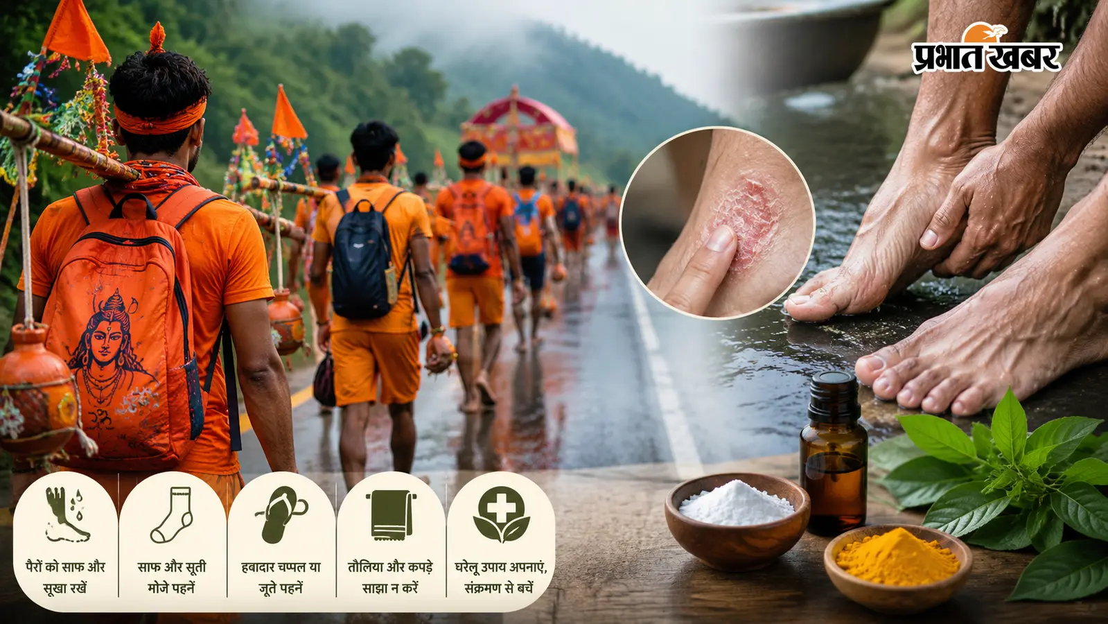 सावन की कांवड़ यात्रा को बनाएं सुरक्षित, फंगल इंफेक्शन से बचने के लिए अपनाएं ये जरूरी टिप्स