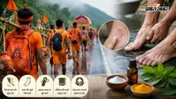 सावन की कांवड़ यात्रा को बनाएं सुरक्षित, फंगल इंफेक्शन से बचने के लिए अपनाएं ये जरूरी टिप्स