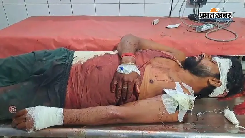श्राद्ध का भोज खाकर लौट रहे साला-बहनोई पर तलवार से हमला, दो गंभीर रूप से घायल; सदर अस्पताल में भर्ती