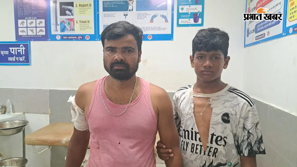 पुरानी रंजिश में युवक को रास्ते में रोककर बदमाशों ने मारी गोली, बाजू को छेदती हुई निकली गोली