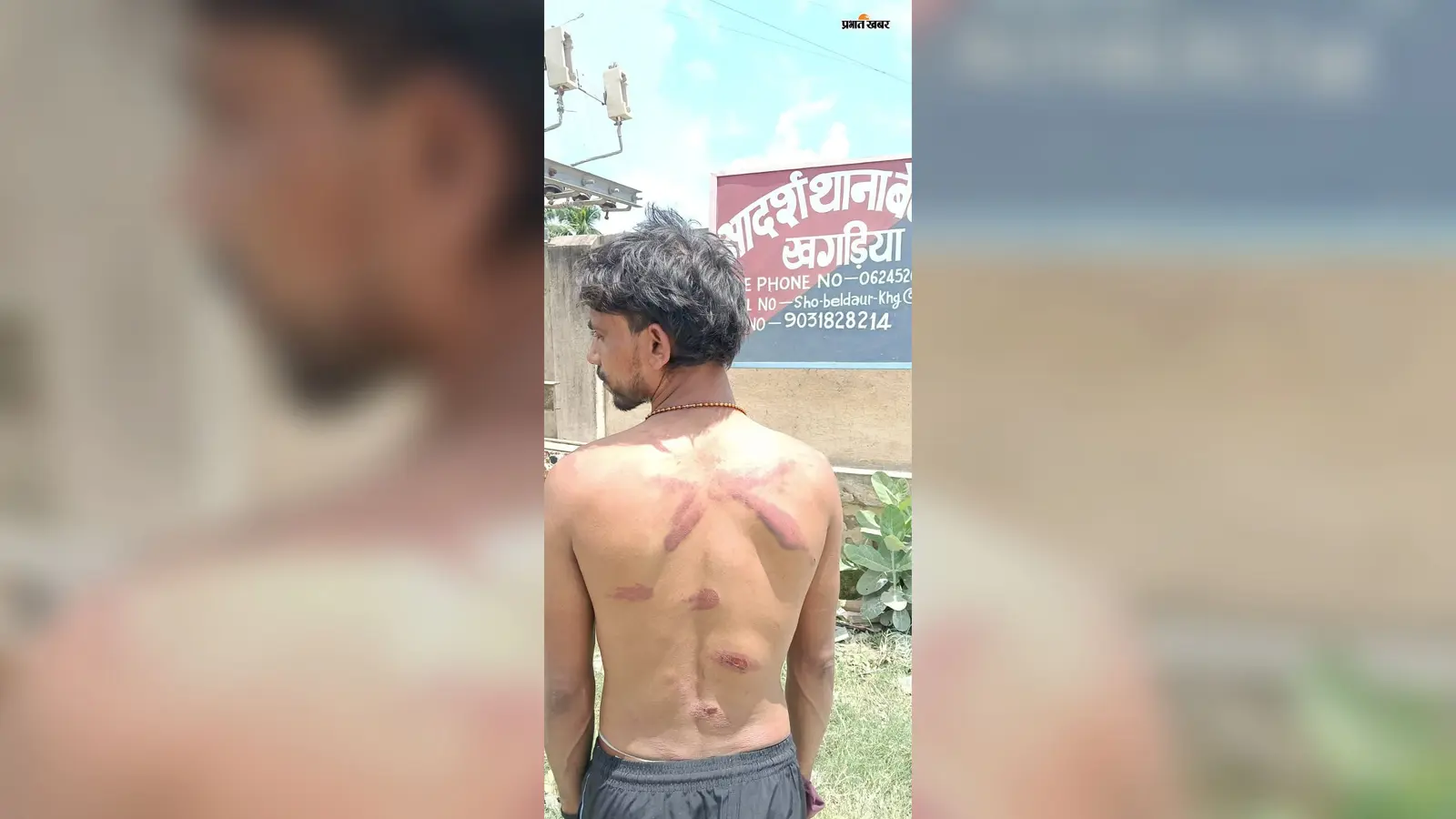 बेलदौर में मामूली विवाद पर युवक के साथ मारपीट व चांदी की चेन छीनने का आरोप, थाने में दिया आवेदन