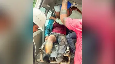 इस्को स्टील प्लांट बर्नपुर में हादसा, 2 मजदूर घायल, दुर्गापुर मिशन अस्पताल में भर्ती