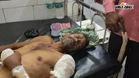 ओझा-गुनी के आरोप में छोटे भाई की लाठी-डंडे से पिटाई, गंभीर हालत में सदर अस्पताल रेफर