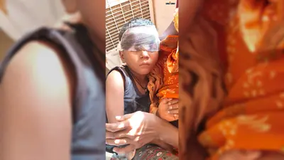 घर के बाहर खेल रही बच्ची पर लोमड़ी का हमला, गंभीर रूप से घायल
