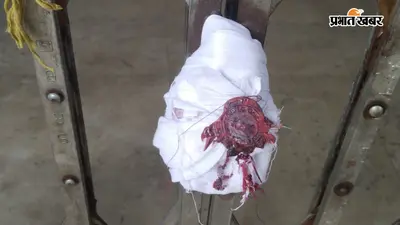 बिना क्लिनिकल एस्टैब्लिशमेंट लाइसेंस चल रहा था मनभूम बीसीएम अस्पताल, सरकार ने किया सील