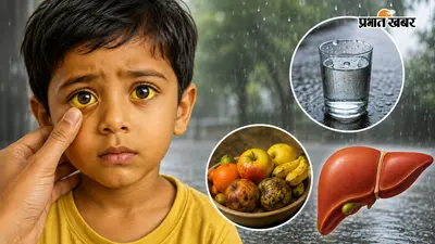बरसात में बच्चों पर मंडरा रहा पीलिया का खतरा, गंदे पानी से लेकर बासी फल तक बन सकते हैं वजह
