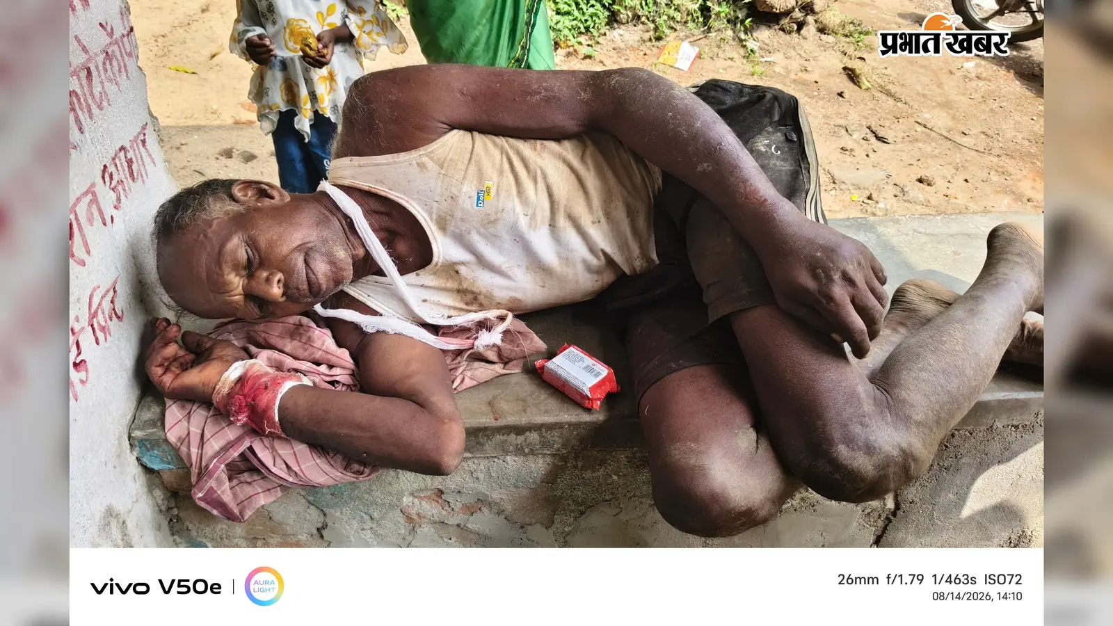जमीन विवाद में खूनी टकराव, गांव में तनाव; पुलिस ने घायलों को अस्पताल पहुंचाया