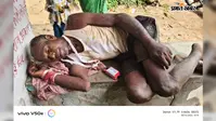 जमीन विवाद में खूनी टकराव, गांव में तनाव; पुलिस ने घायलों को अस्पताल पहुंचाया