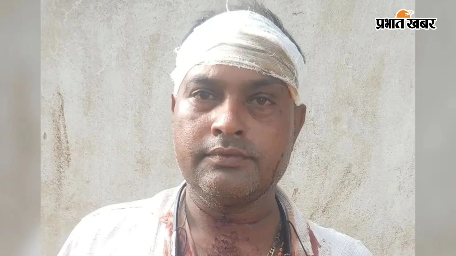 औरंगाबाद में पारिवारिक विवाद में बेटे ने पिता के सिर पर लोहे की रॉड से किया हमला, पत्नी और पुत्र पर केस दर्ज