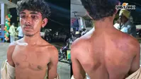 पटना में किशोर को काले शीशे वाली गाड़ी से उठा ले गये बदमाश, 4 घंटे तक पीटा, जलती सिगरेट से बनाया 3 का निशान