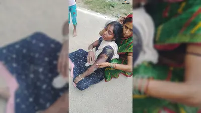 जदिया में बच्चों के विवाद के बाद बड़ों में मारपीट, महिला पर गर्म तवे से हमला करने का आरोप