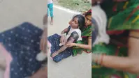 जदिया में बच्चों के विवाद के बाद बड़ों में मारपीट, महिला पर गर्म तवे से हमला करने का आरोप
