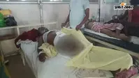 हाजीपुर: मेले में युवक को घेरकर पीटा, तेजाब फेंकने का आरोप; पुलिस बोली- गर्म तेल से झुलसने की बात