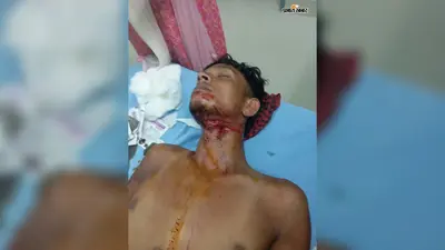 परबत्ता: स्मैक पीने के लिए पैसे नहीं देने पर मीनापुर में युवक पर धारदार हथियार से जानलेवा हमला