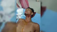 परबत्ता: स्मैक पीने के लिए पैसे नहीं देने पर मीनापुर में युवक पर धारदार हथियार से जानलेवा हमला