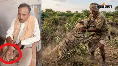 लकड़बग्घे से भिड़ गया किसान, तीन-चार मिनट तक चली उठापटक; दांत से काटकर भागा जंगली जानवर