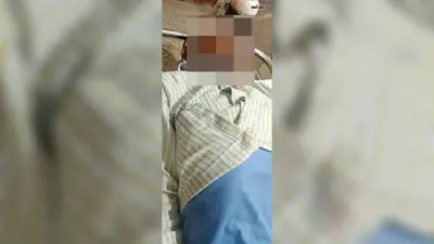 चलते ऑटो से सड़क पर गिरे बुजुर्ग, घायल को छोड़ चालक फरार; इलाज जारी