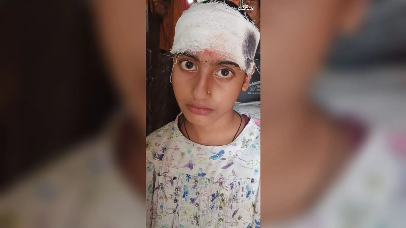 Motihari: टिफिन के दौरान बेंच से गिरकर छात्रा घायल, स्कूल की निगरानी व्यवस्था पर उठे सवाल