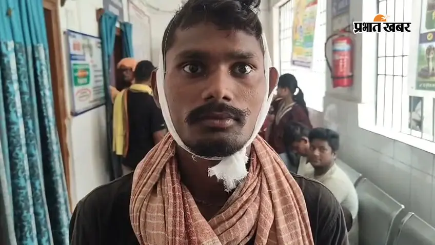 सासाराम : चेनारी में शराब पीने से मना करने पर युवक पर लाठी से हमला, सिर में लगी गंभीर चोट