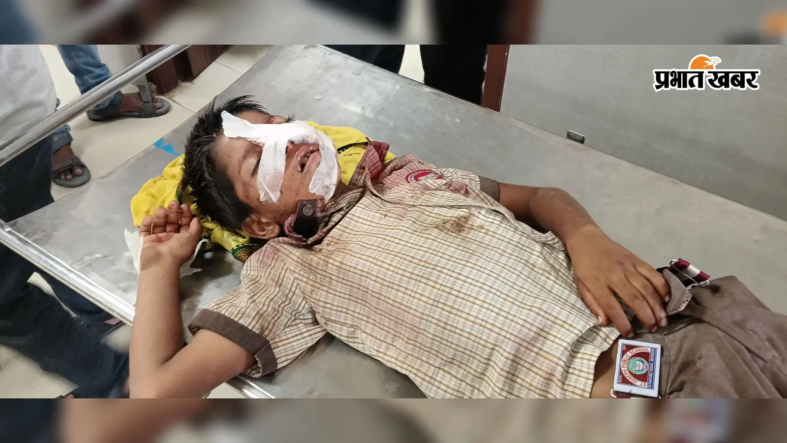 मुंगेर में स्कूल से लौटते बच्चे को पीछे से वाहन ने मारी टक्कर, साइकिल समेत सड़क पर गिरा 9 साल का आयुष