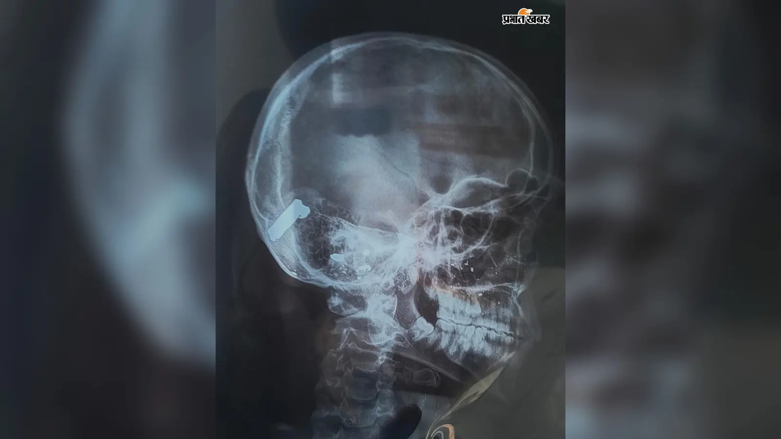 गोपालगंज : महाबीरी अखाड़े के दौरान युवक की सिर में गोली मारकर हत्या, सीसीटीवी फुटेज खंगाल रही पुलिस