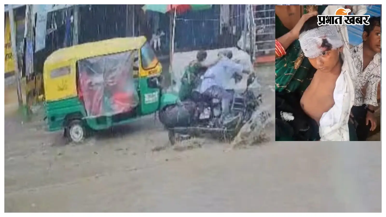 मुसहरी में सड़क के जानलेवा गड्ढे के कारण बाइक पलटी, बच्चे का सिर फटा