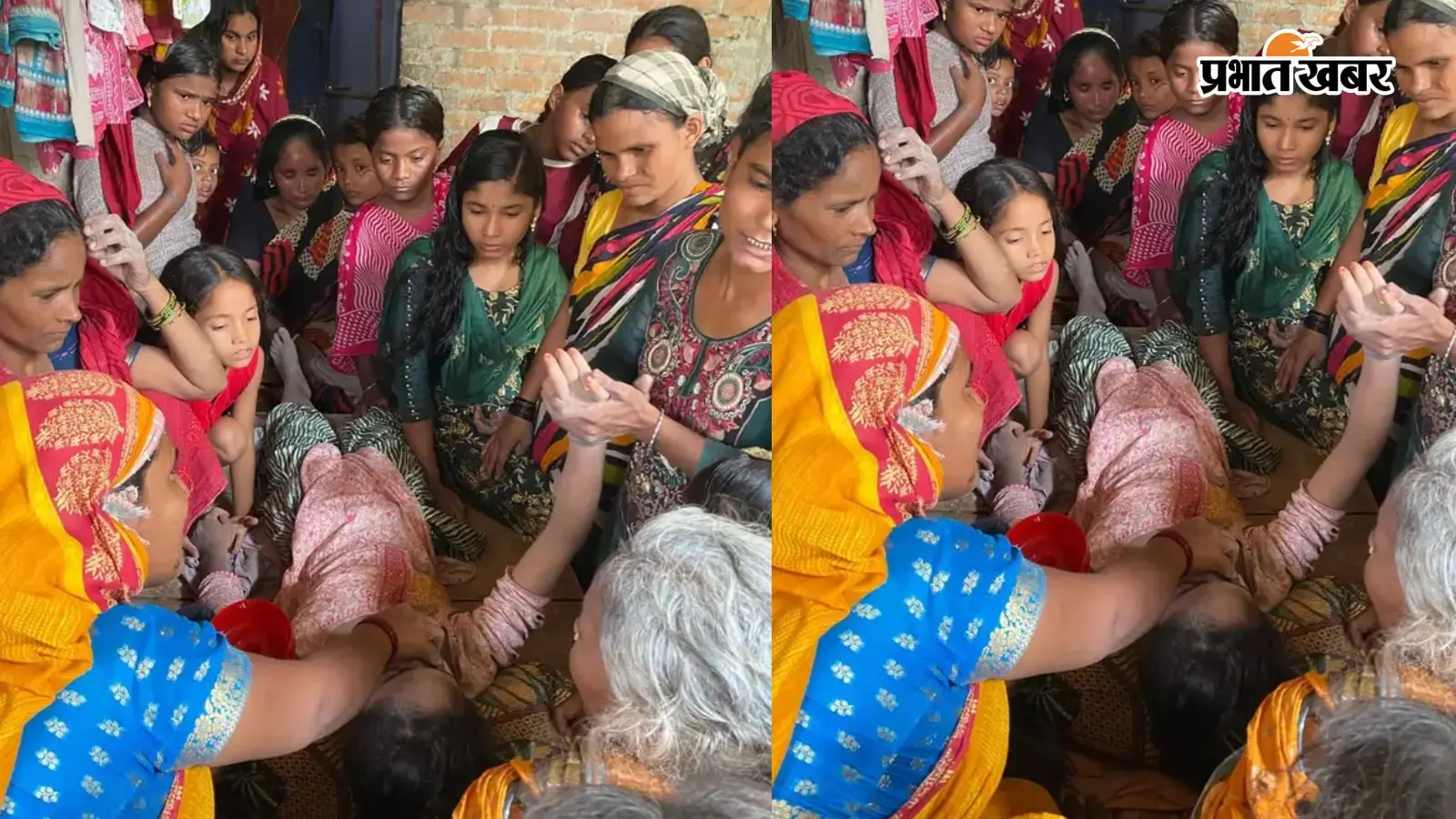 चापाकल पर पानी भरते समय गिरा जर्जर एलटी तार, किशोरी समेत तीन लोग करंट से झुलसे