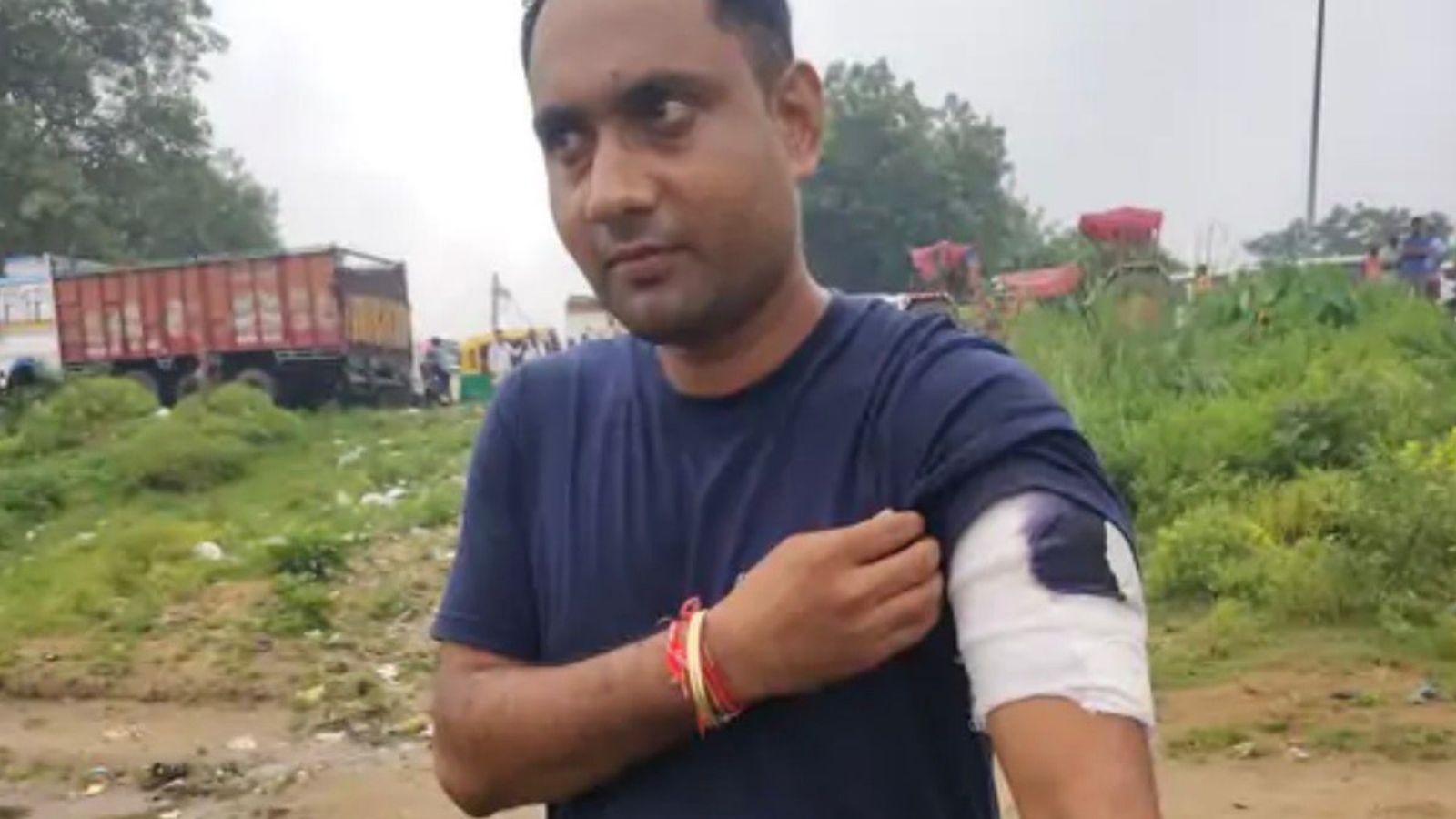 मुठभेड़ में गोली से घायल SI