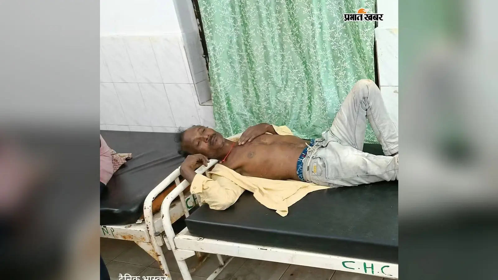 चाईबासा में आसमान से बरसी आफत, पति-पत्नी समेत चार लोग झुलसे