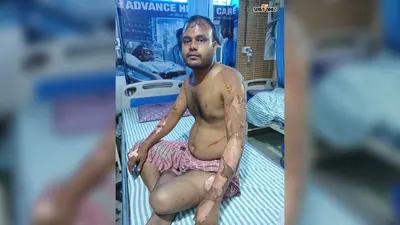 मधुबनी: घोघरडीहा में शॉर्ट सर्किट से दो घरों में लगी आग, चार पशु झुलसे, युवक घायल