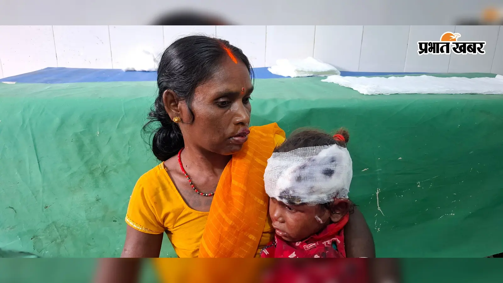 दो बाइकों की सीधी टक्कर में एक ही परिवार के तीन घायल, पिता-पुत्र गिरिडीह रेफर