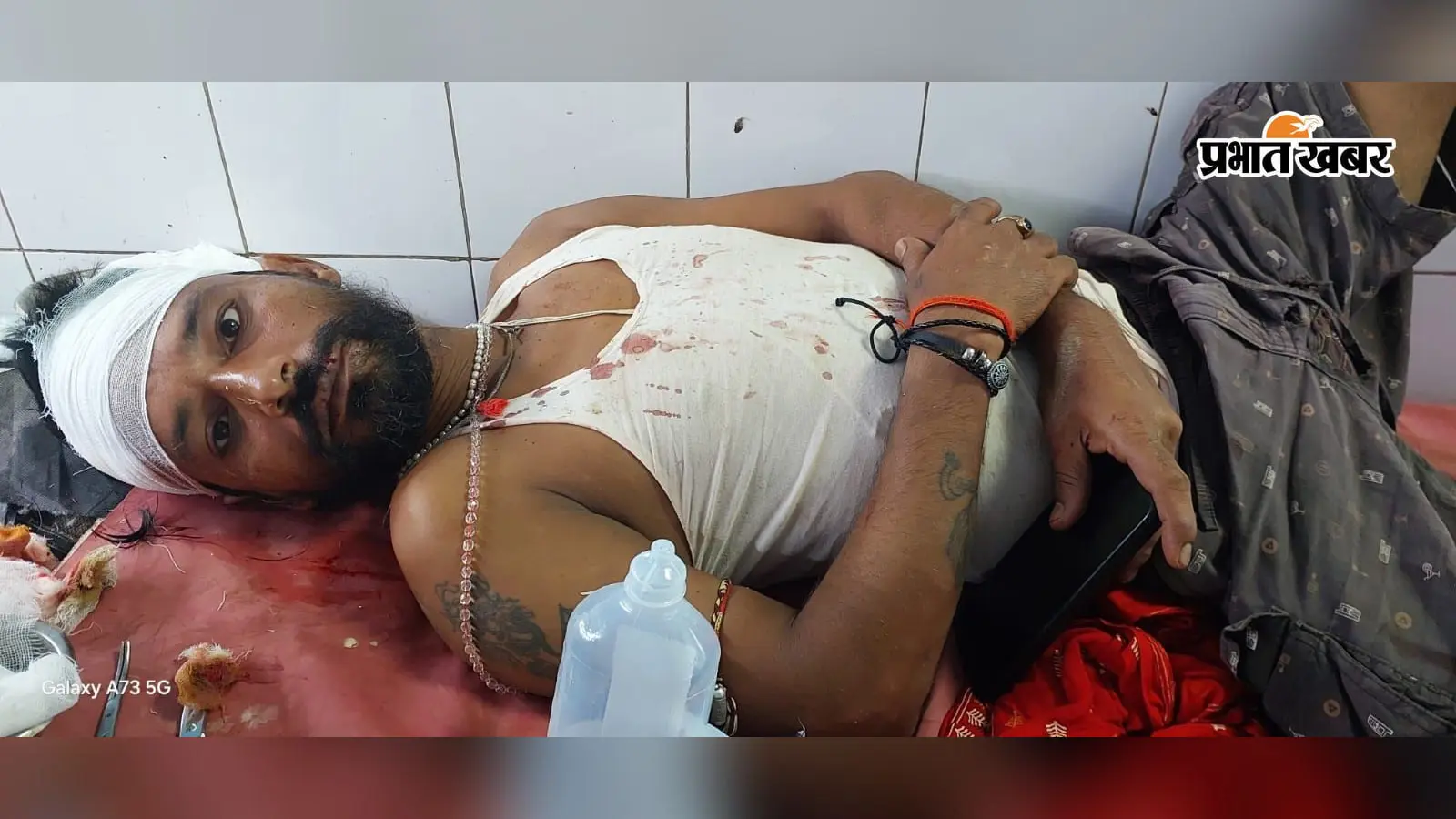 लखीसराय: तेतरहाट के शर्मा गांव में आम गैरमजरुआ जमीन को लेकर भिड़े दो पक्ष, जमकर हुई मारपीट; युवक गंभीर रूप से घायल