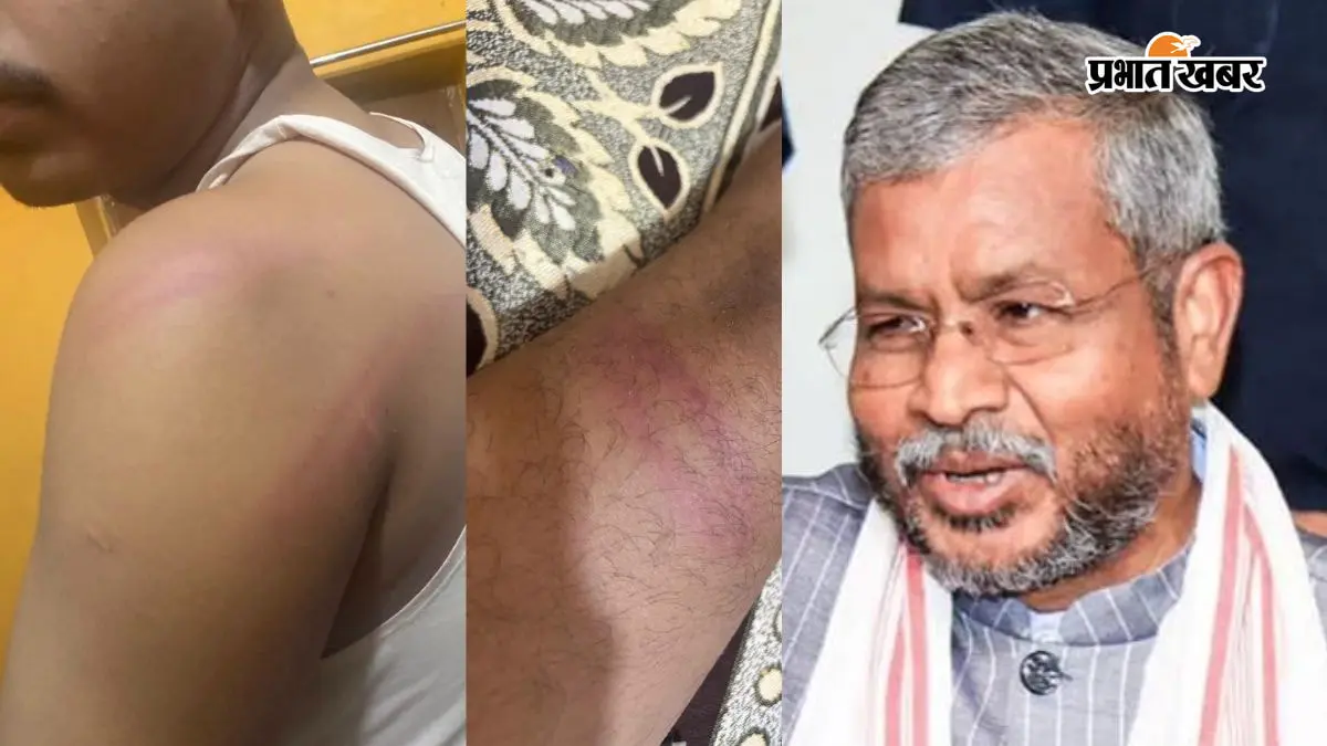 गिरिडीह में भाजपा कार्यकर्ताओं पर लाठीचार्ज का आरोप, बाबूलाल मरांडी ने कार्रवाई की मांग की