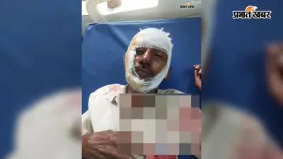 तेज रफ्तार अज्ञात वाहन ने बाइक में मारी टक्कर, चाचा-भतीजा गंभीर घायल