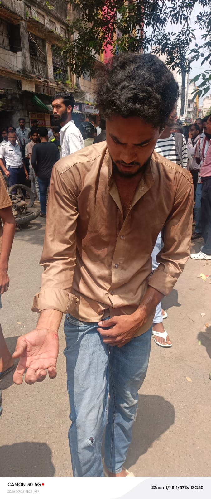 चेकिंग के दौरान गिरने से घायल युवक.