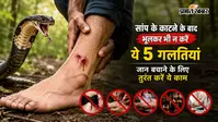 सांप के काटने के बाद भूलकर भी न करें ये 5 गलतियां, जान बचाने के लिए तुरंत करें ये काम