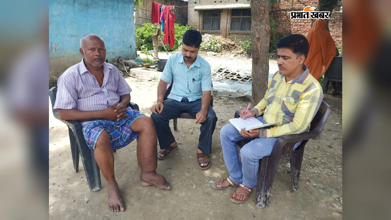 मधुबनी में लिम्फोडेमा मरीजों के लिए बड़ा कदम, पात्र लोगों को मिलेगा दिव्यांगता प्रमाणपत्र