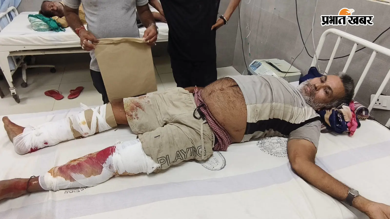 पैर में गंभीर चोट, इलाज के नाम पर गत्ता लपेटकर कर दिया रेफर! मुंगेर सदर अस्पताल की व्यवस्था पर उठे सवाल