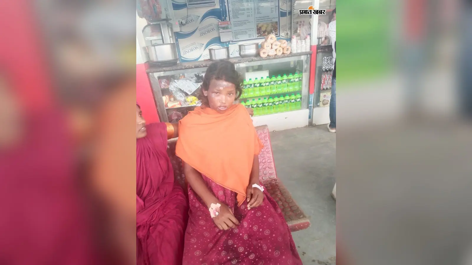 अररिया: बथनाहा के मधुबनी गांव में धान रोपते समय गिरा ठनका; मां-बेटी गंभीर रूप से झुलसीं