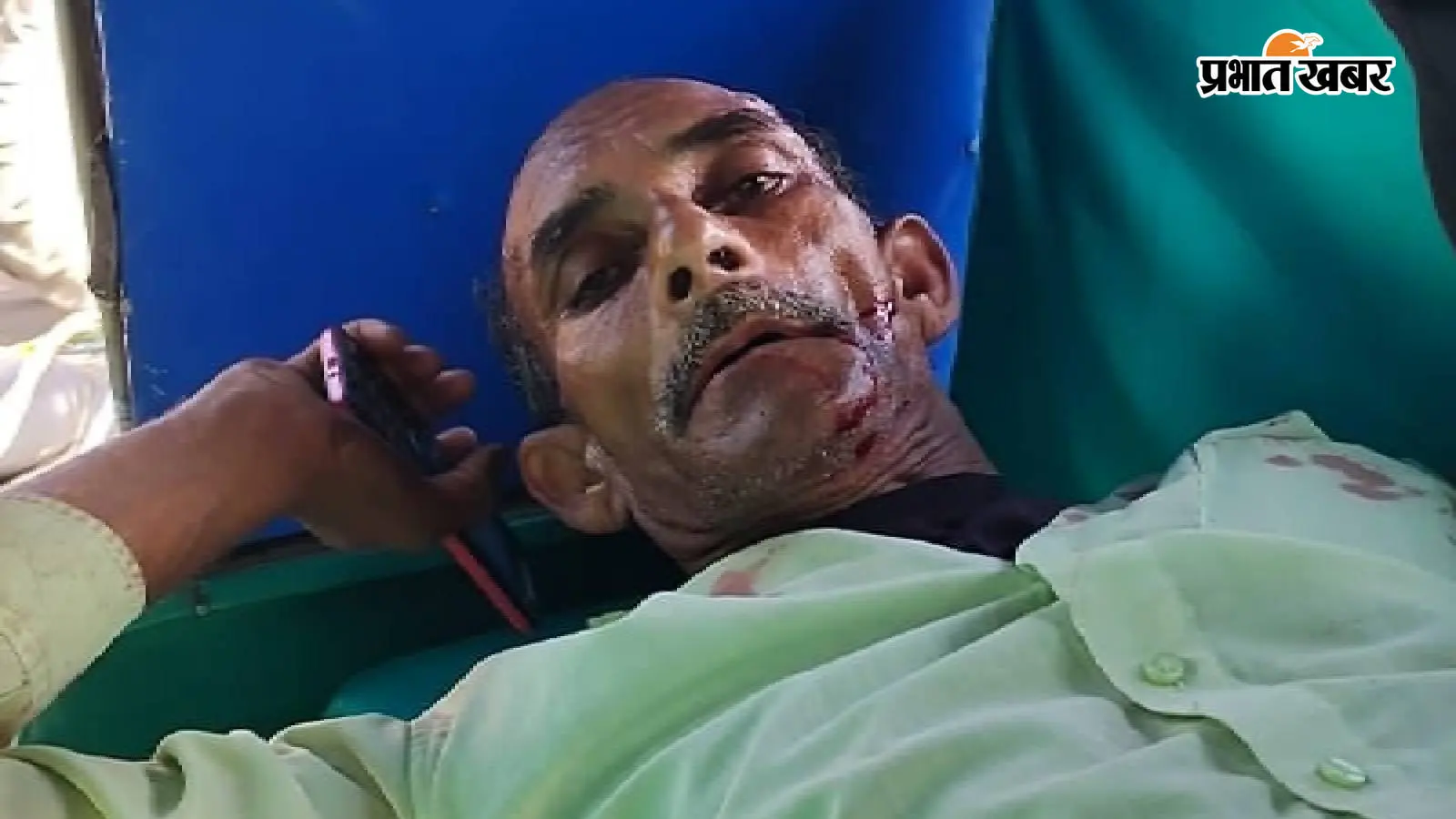 बिहटा स्टेशन के पास रेल हादसा: ट्रेन की चपेट में आने से व्यक्ति का कटा पैर, अस्पताल में भर्ती