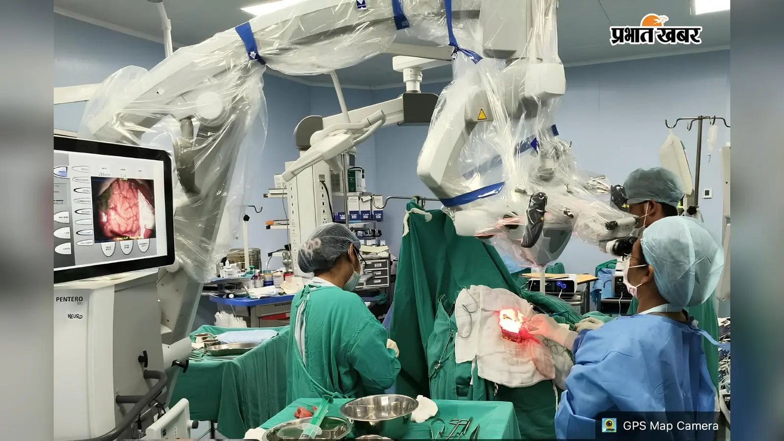 होश में रहा मरीज, खुली खोपड़ी... AIIMS देवघर में पहली बार ब्रेन ट्यूमर की सर्जरी