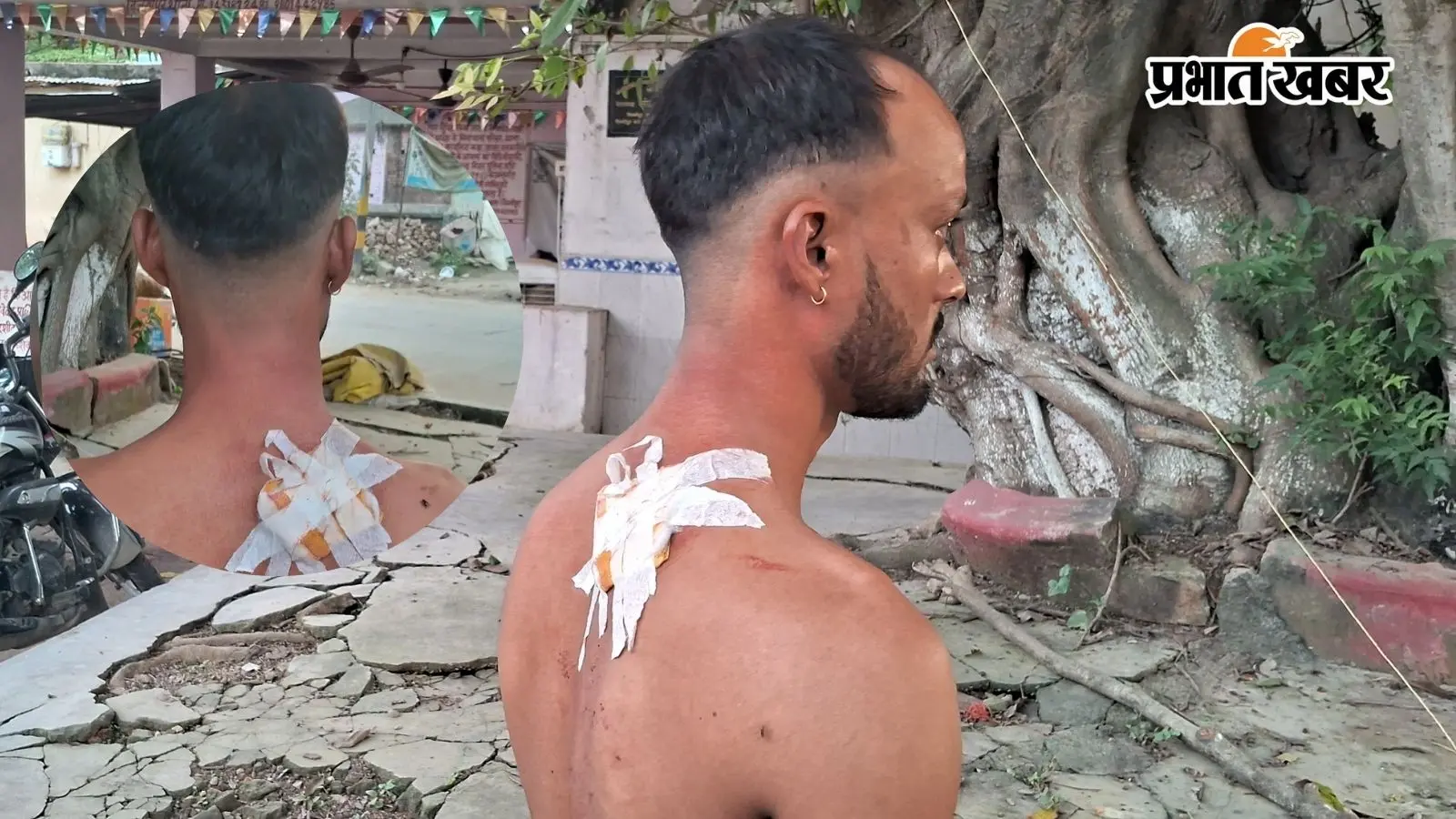 गोपालगंज में युवक पर चाकू से जानलेवा हमला, पेट और पीठ पर वार कर किया घायल