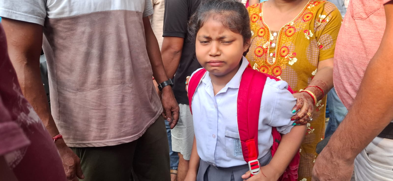 घायल बच्ची