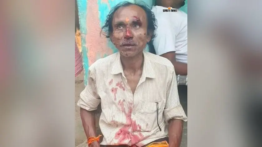 सड़क के गड्ढे में गिरकर करम महोत्सव में शामिल कलाकार घायल, ग्रामीणों ने की मरम्मत की मांग