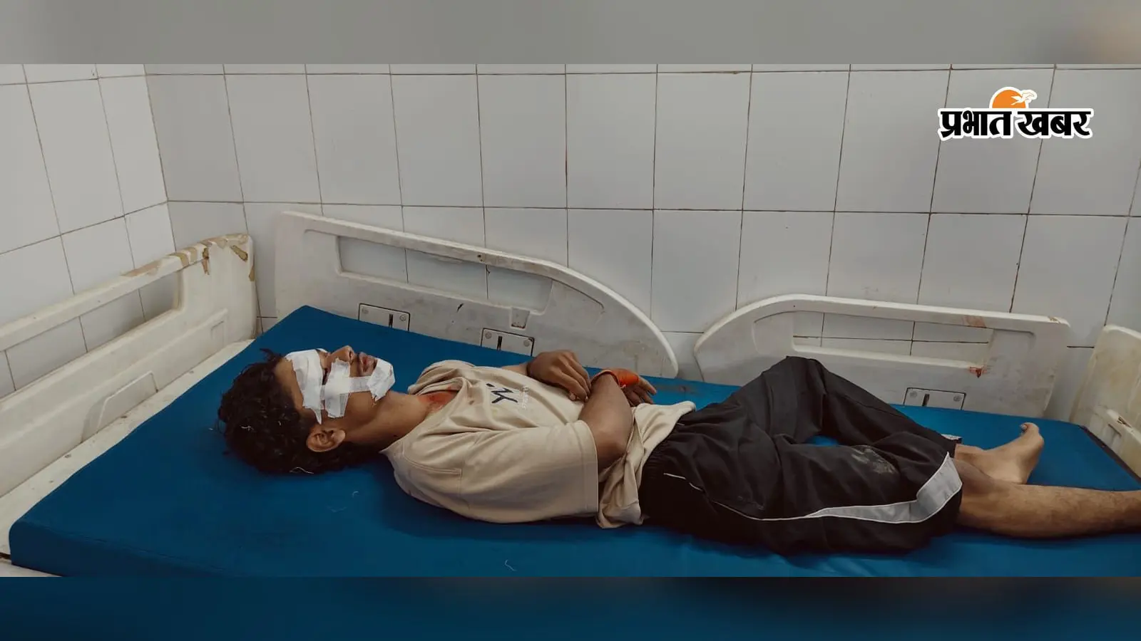ट्यूशन जा रहे युवक की स्कूटी में अज्ञात वाहन ने मारी जोरदार टक्कर, चालक वाहन लेकर फरार